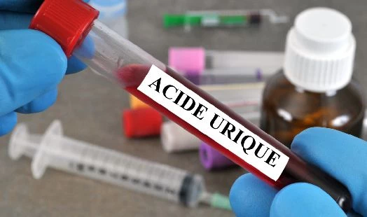 Goutte (acide urique trop élevé)